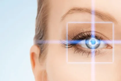 Cosmetic Laser Eye Surgery